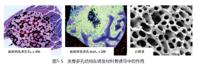 Q1-1 Biomaterials for bone regeneration