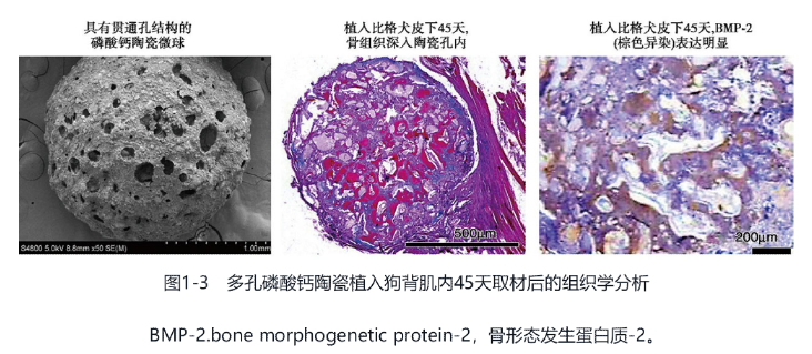 Q1-1 Biomaterials for bone regeneration