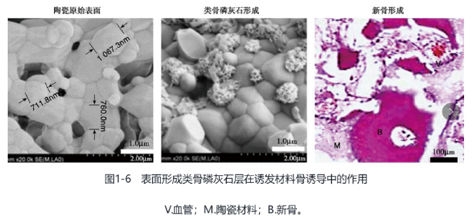 Q1-1 Biomaterials for bone regeneration
