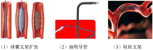 2023年神经介入器械行业市场规模增长率分析及重点企业竞争战略研究预测