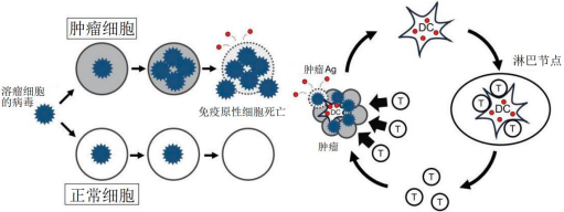 2023年全球及中国溶瘤病毒抗癌药物行业重点企业竞争规模格局分析及投资发展建议可行性研究预测