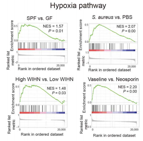 共生微生物通过诱导角质形成细胞HIF-1α信号通路和谷氨酰胺代谢促进毛囊再生 共生微生物通过诱导角质形成细胞HIF-1α信号通路和谷氨酰胺代谢促进毛囊再生