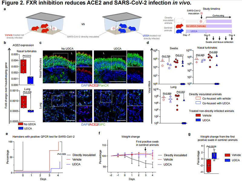 FXR抑制可减少ACE2以保护SARS-CoV-2感染 FXR抑制可减少ACE2以保护SARS-CoV-2感染