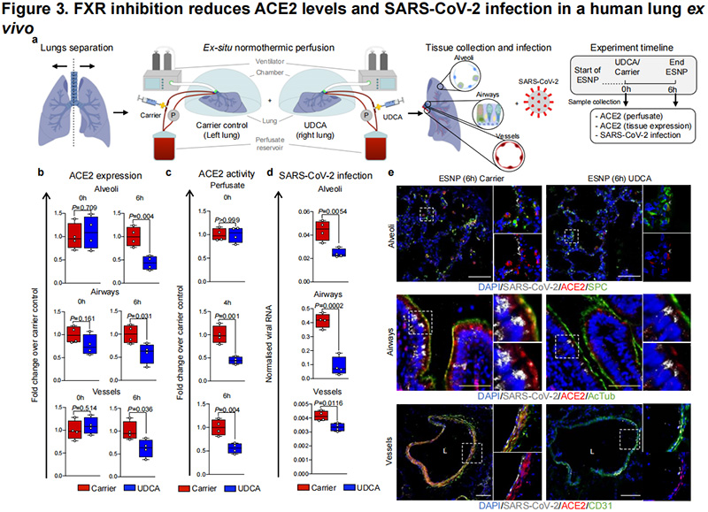 FXR抑制可减少ACE2以保护SARS-CoV-2感染 FXR抑制可减少ACE2以保护SARS-CoV-2感染