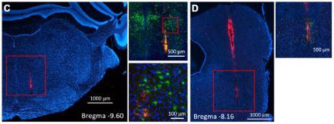 【NeuroNexus客户文章】NEURAL MECHANISMS OF ALTERED SENSORIMOTOR PROCESSING IN ASD AND OTHERS