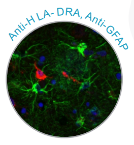 Atlas Antibodies——专注于高品质IHC抗体研发