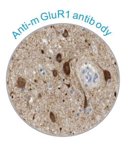 Atlas Antibodies——专注于高品质IHC抗体研发