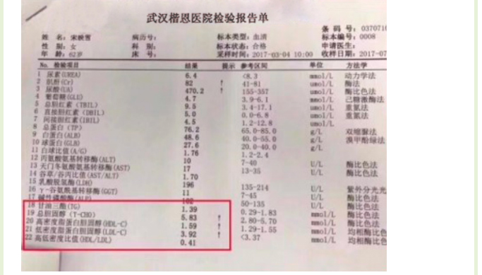 坐 2 小时就可能形成血栓！这 3 个地方痛，就要小心了