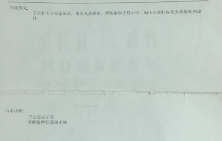 多囊7年不孕，3促4移终好孕，分享区女士的海外试管经历