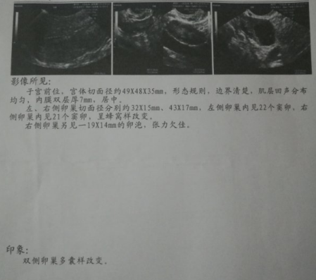多囊不孕，泰国三代试管婴儿，一次喜获龙凤胎