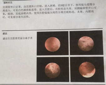 宝爸：假如这个子宫是许先生的，8年求子路许先生能坚持吗？