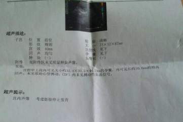 宝爸：假如这个子宫是许先生的，8年求子路许先生能坚持吗？