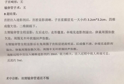 输卵管不通，人授2次失败，试管一次成功好孕