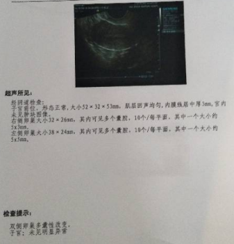 多囊久备不孕，1促1移好孕，分享蔡女士的真实经历