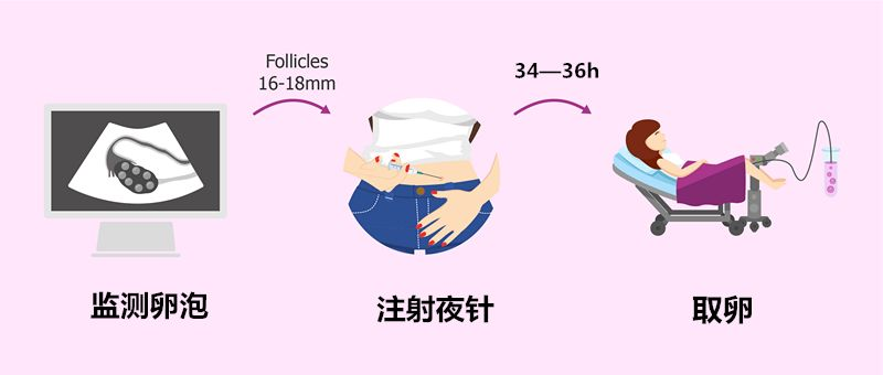 完美利用每一颗卵子|促排卵方案全解析篇