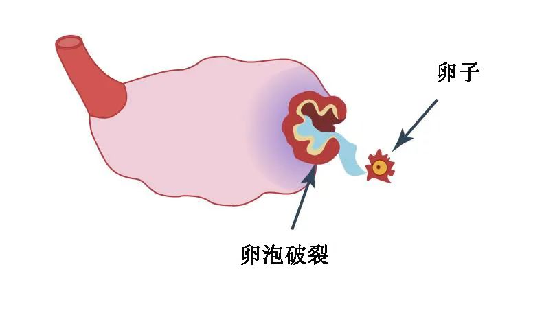 月经和子宫出血