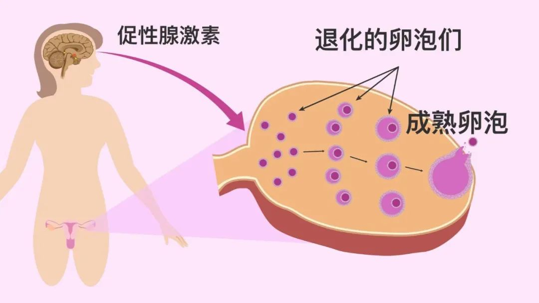 自然流产，可能是胰岛素有问题