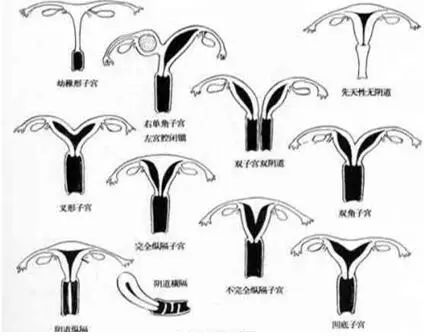 “石女”能结婚生子吗? “石女”能结婚生子吗?