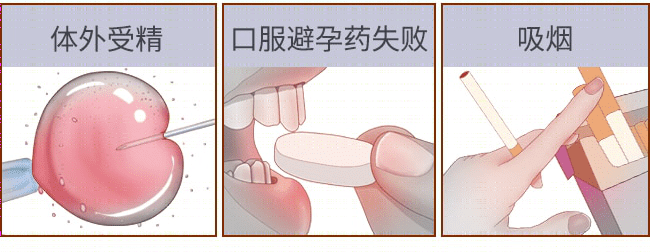 “要命”的宫外孕,最爱找这 7 种人 “要命”的宫外孕,最爱找这 7 种人