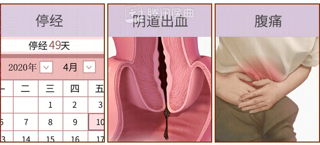 “要命”的宫外孕,最爱找这 7 种人 “要命”的宫外孕,最爱找这 7 种人