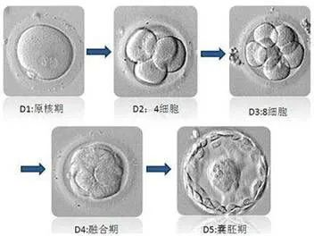 科普课堂 | 什么是第三代试管婴儿技术？