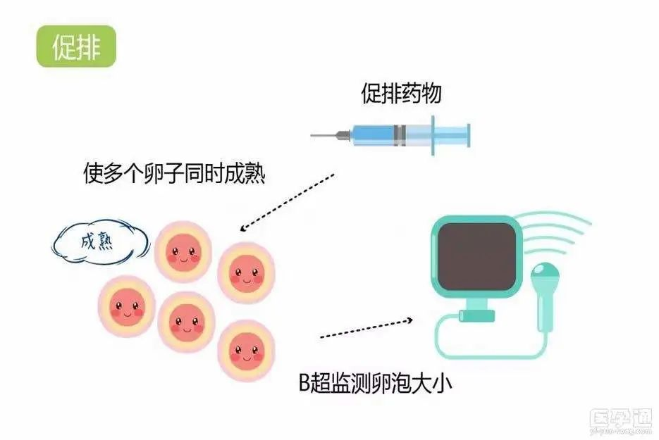 科普课堂 | 什么是第三代试管婴儿技术？