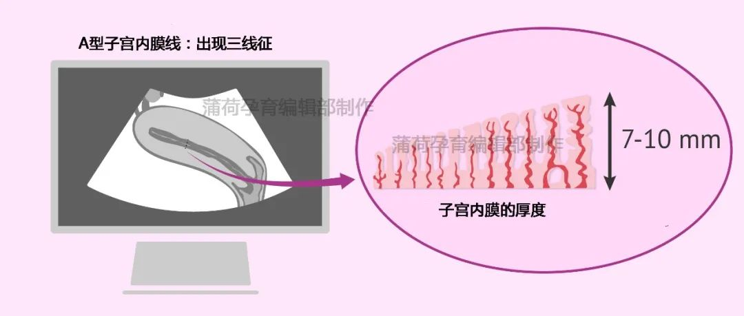 胚胎移植后便秘的原因简单分析和自我改善小tips 胚胎移植后便秘的原因简单分析和自我改善小tips