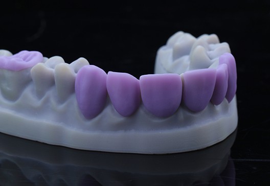 XTCERA Glass Ceramic Block