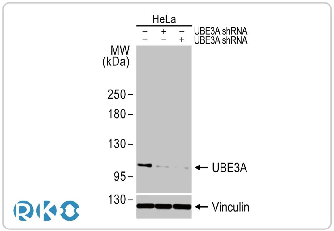 UBE3A泛素连接酶E3重组单克隆抗体
