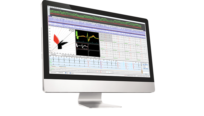 Holter Software