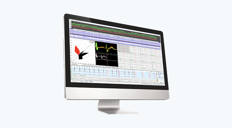 Holter Software