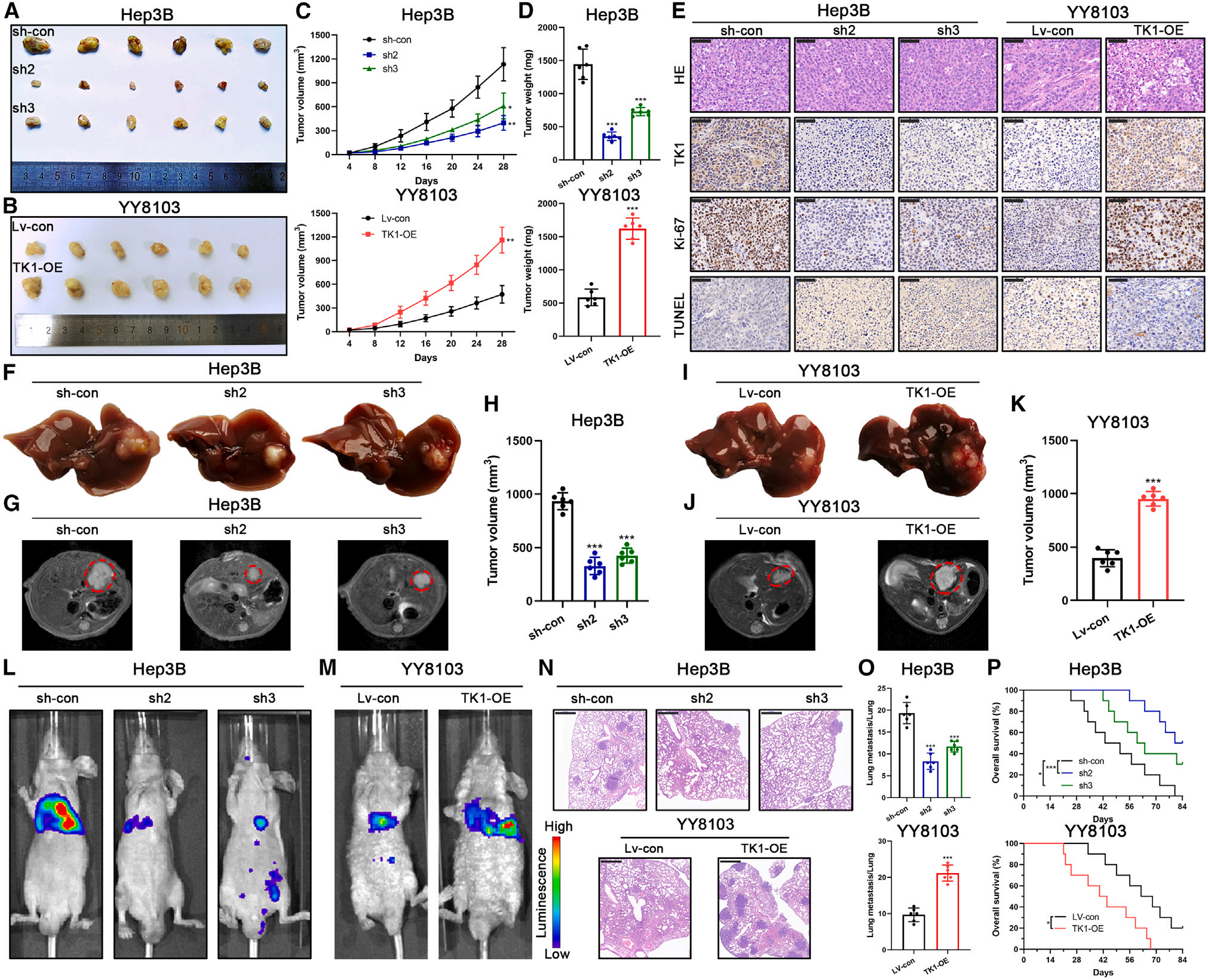 Cell Metab（IF31.373）｜南医大王学浩院士、武大张鹏团队发现肝细胞癌关键驱动因素：胸苷激酶1