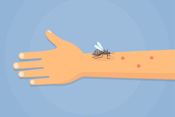 为什么蚊子会成为四害之一，它都有哪些危害？