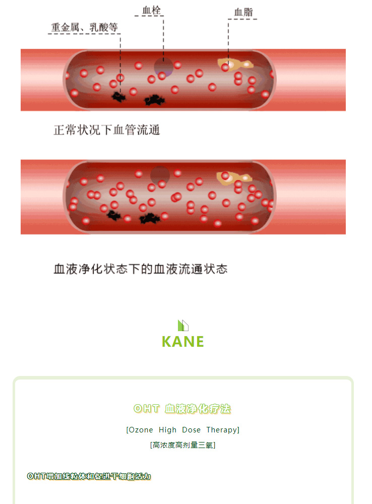 OHT 三氧疗法 | 净化血液纯净度，祛除血液垃圾