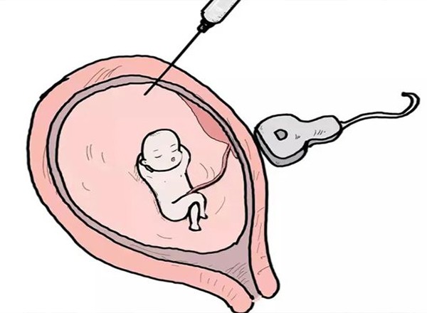 孕期亲子鉴定，最安全的原来是这种？