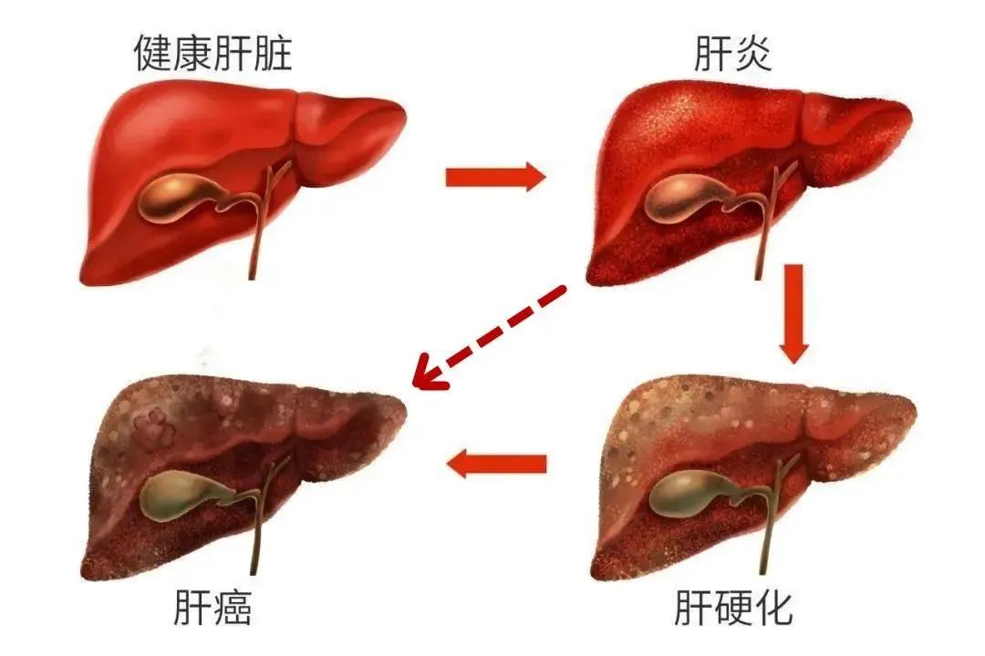 【亮点剧透】美地港医疗新品发布“消化系统重塑”——2023长三角度假医疗绿色健康高峰论坛