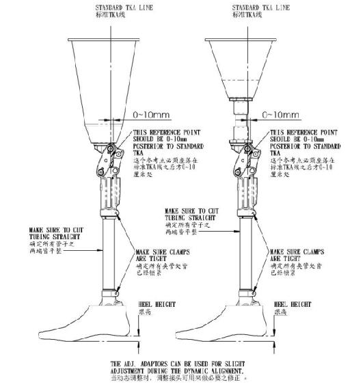 假肢穿戴舒服的三要素：接受腔，对线，康复训练