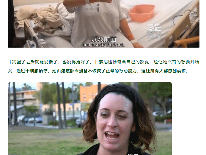 中风案例丨干细胞回输仅一天，她的手臂竟抬起来了！