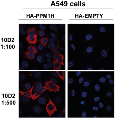 StressMarq新品推荐-Tau 和 Alpha 突触核蛋白共聚集体原纤维，Tau抗体，PPM1H抗体