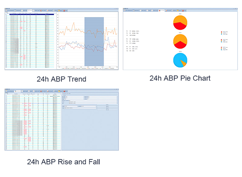 Ambulatory Blood Pressure System - TeleABP