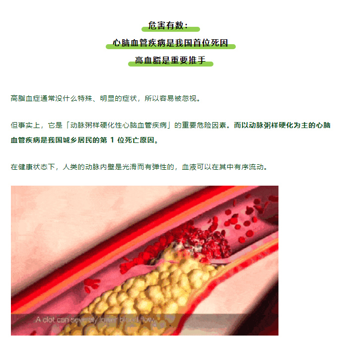 第一批 00 后已经高血脂了！想降脂，这 3 个误区不能踩