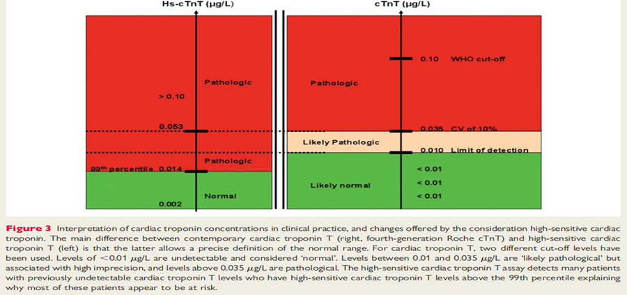 高敏肌钙蛋白检测技术在急性心梗诊断中的应用价值