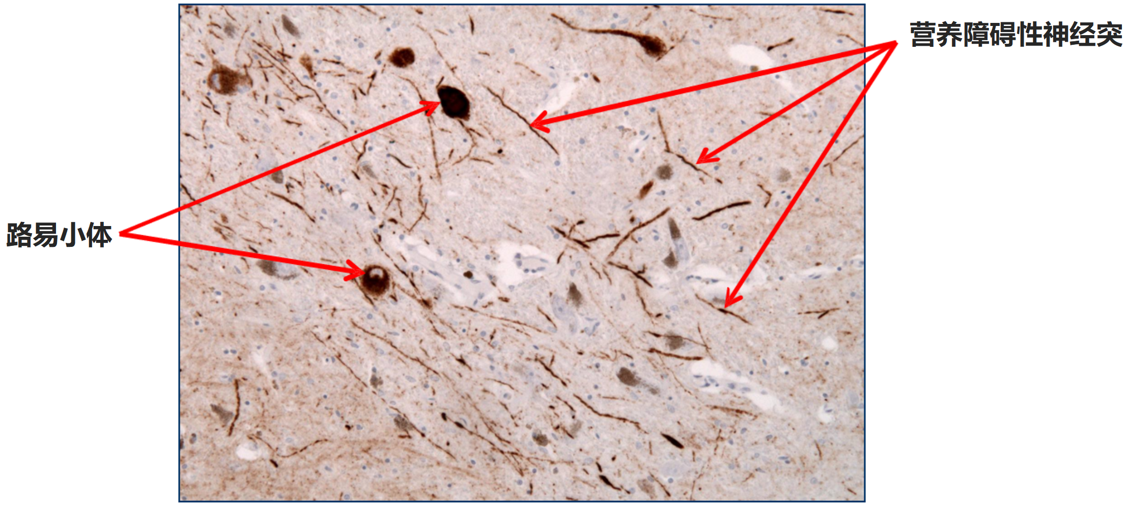 Stressmarq——Alpha突触核蛋白&神经退行性疾病
