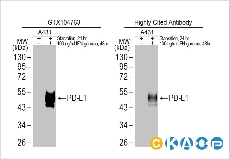 IFNγ刺激的KAT8-IRF1凝聚体可激活PD-L1表达并促进免疫逃逸
