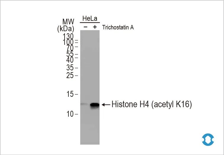 IFNγ刺激的KAT8-IRF1凝聚体可激活PD-L1表达并促进免疫逃逸