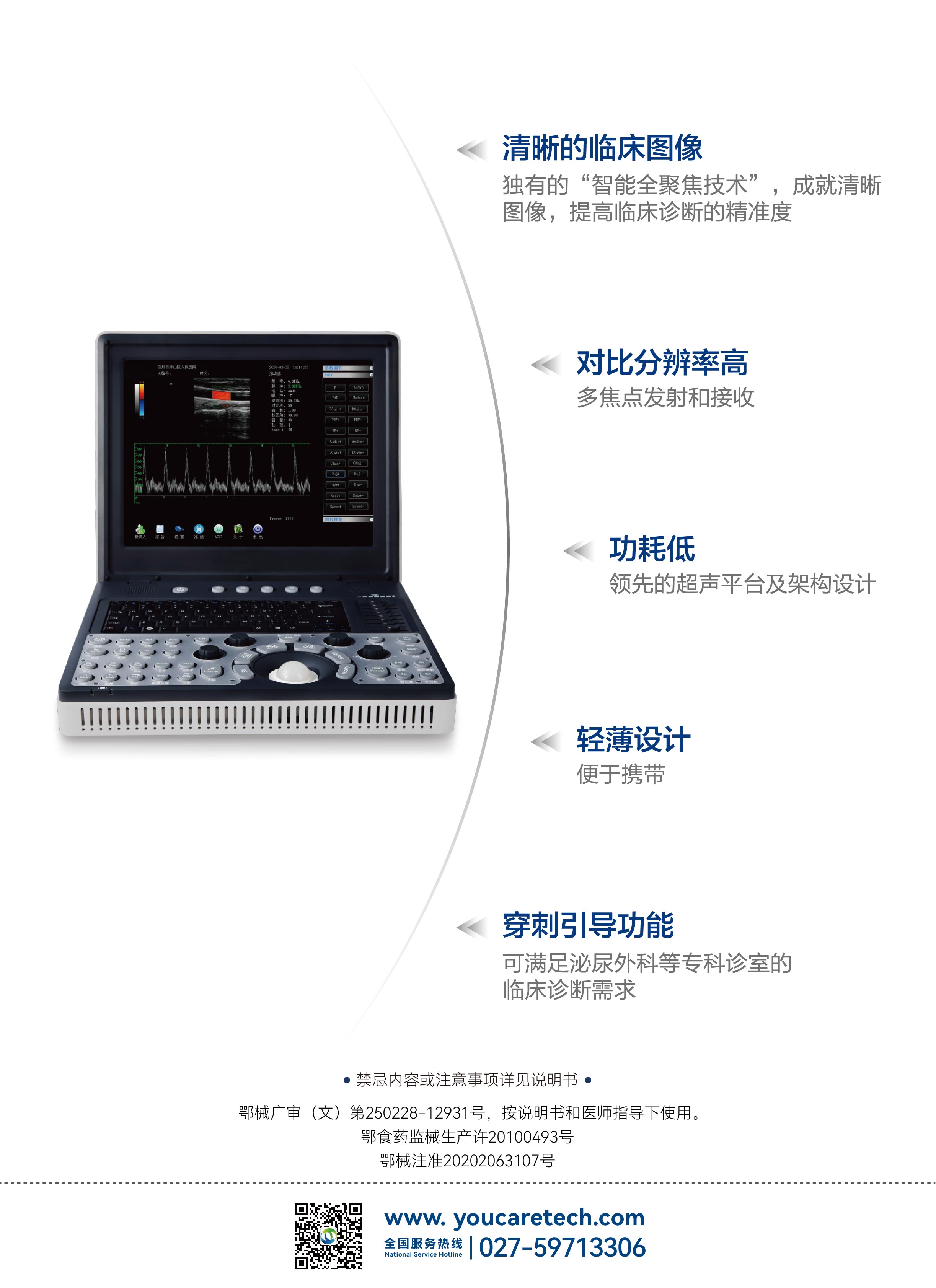 Medical Ultrasound Instruments Portable Color Doppler Digital Ultrasound Machine YC-DUD-A