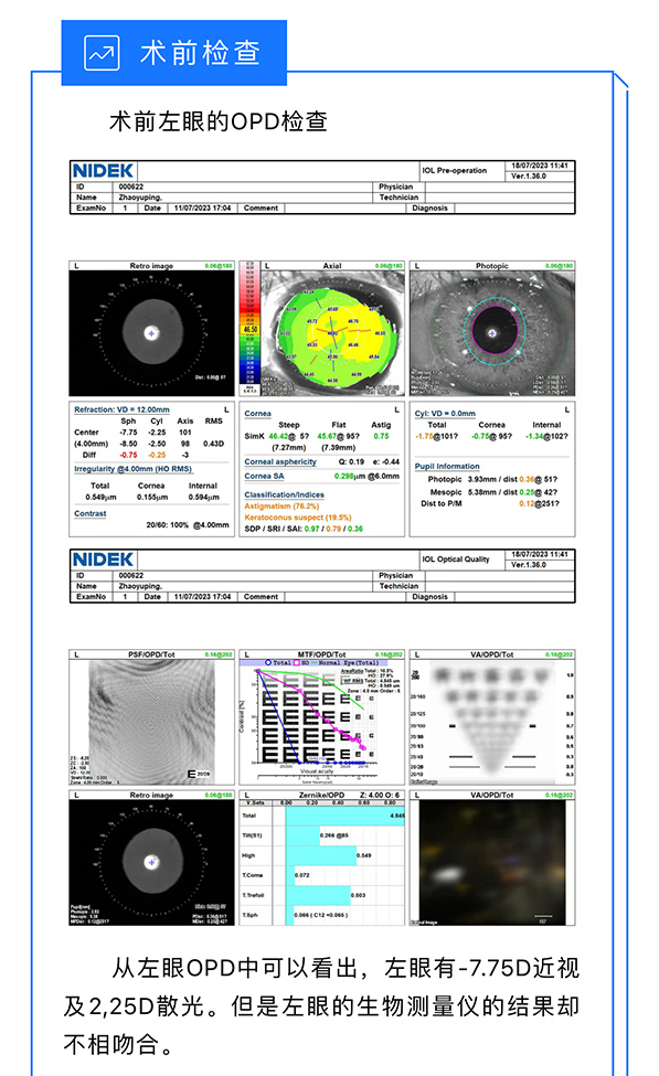 视网膜色素变性与多焦点人工晶状体