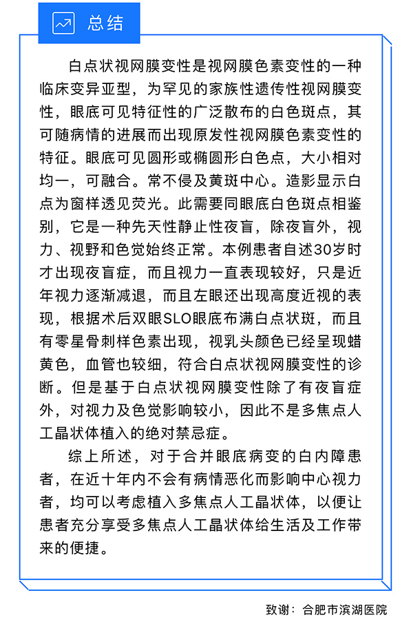 视网膜色素变性与多焦点人工晶状体