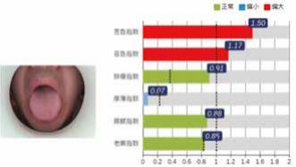 积分球光源中医舌诊仪