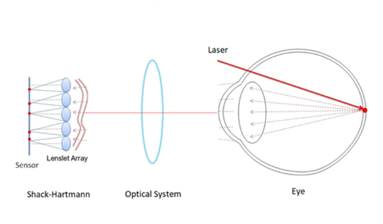 用于眼睛像差評估的Shack?Hartmann傳感器建模
